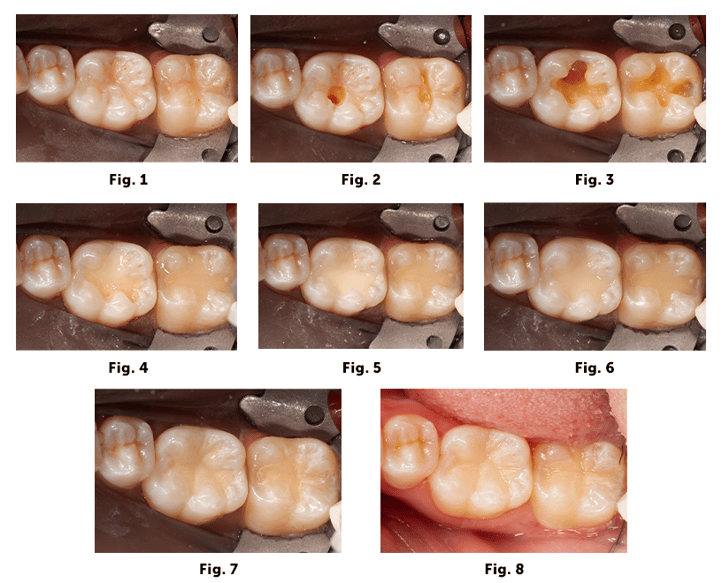 group case 1.2