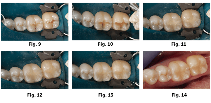 group case 2.2