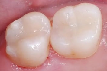 image2 (2)-1