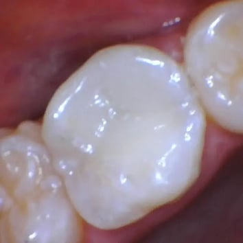 image4 (3)-1