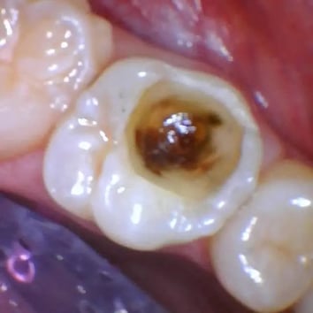 image5 (2)-1