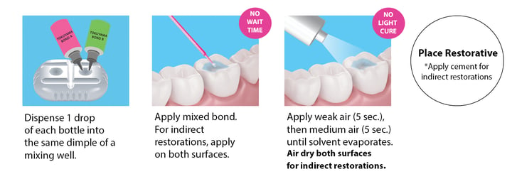 Dental Adhesive Procedure